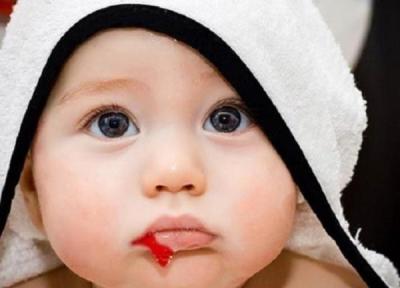 دانستنی های مهم در ارتباط با استفراغ خونی در بچه ها
