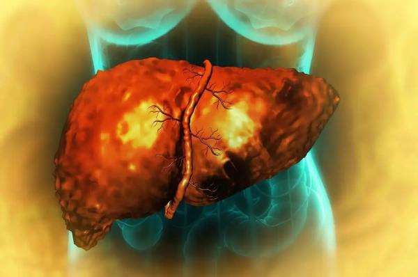 دارویی که از حنا به دست آمده، شاید بتواند روند فیبروز کبد دارویی که از حنا به دست آمده، شاید بتواند روند فیبروز کبد را مهار و حتی معکوس کند!